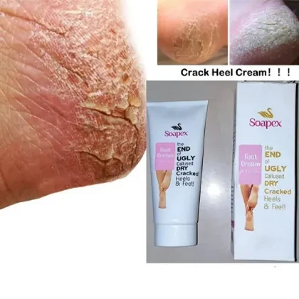 Healing Cream price in Pakistan